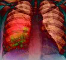 Pinworms во белите дробови и носот