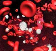 Акутна анемија кои произлегуваат од загуба на крв