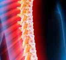 Акутна трансверзален миелитис, на 'рбетниот мозок: третман, прогнозата