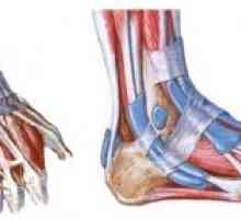 Акутна tendonitis од областа на зглобот