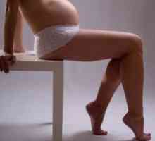 Отекување на нозете во текот на бременоста: причини, третман