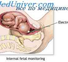 Одред и раѓањето на плацентата. Болка за време на породувањето