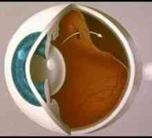 Ретинална аблација очи: причините, симптомите, третман, симптомите