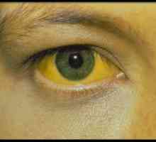 Панкреатитис, и хепатитис со жолтица во заболување на панкреасот