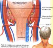 Патофизиологија на паратироидните жлезди