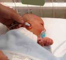Перивентрикуларна леукомалација кај предвремено родените бебиња