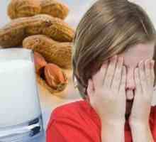 Алергии на храна кај децата постари од 7 години