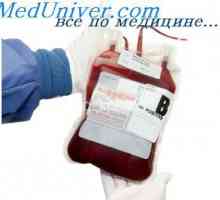 Индикации и контраиндикации за трансфузија на црвени крвни клетки во новороденчињата