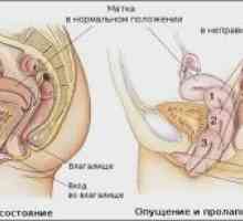 Малформации на матката: дијагноза и третман