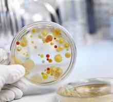 Сеење на фекална прекумерен раст бактерии