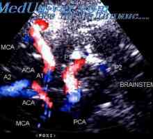 Precardial гас меурчиња. На обемот на гасна фаза во централниот венски систем