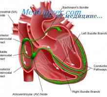 Срцева систем спроводливост. синусниот јазол