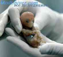 Патишта ембрионот. Формирање на проводен патеки фетусот