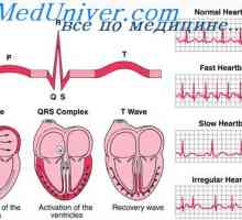 Срцевиот циклус. Порака електрокардиограм и срцевиот циклус