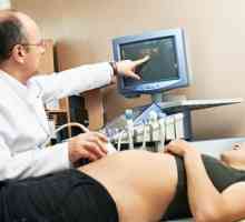 Моларна бременост за време на бременоста, знаци, симптоми, причини, третман