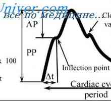 Артериски варијации пулсот притисок. Промени на пулсниот притисок