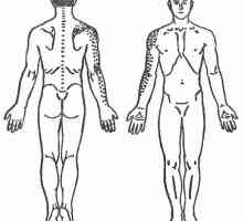 Истегнување на мускулите на рацете со болки во грбот
