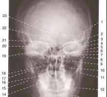 Черепот на Х-зраци анатомија