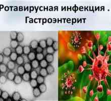 Ротавирус гастроентеритис