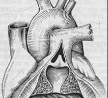 Срцето и големите крвни садови. Тетралогија на Фало