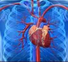 Срцева слабост во атеросклеротични cardiosclerosis, третман причини