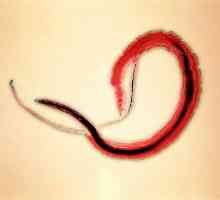 Bilharzia (шистозомијаза, bilharzia), предизвикувачкиот агенс на крвта (Јапонски) трематоди