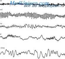 Мозочните бранови и нивото на активноста на мозокот. Еден Електроенцефалограмот (ЕЕГ) сон
