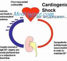 Кардиоген шок. Физиологија на третманот на кардиоген шок