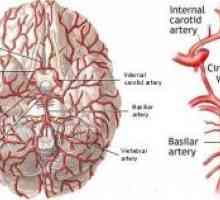 Васкуларни болести на мозокот