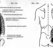 Болки во грбот предизвикани од мускулите на строител spinae