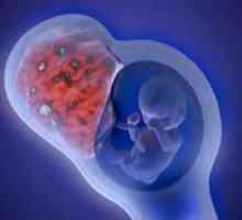 Формирање на матката-плацентарната циркулација