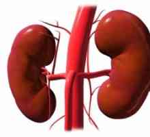 Стеноза и оклузија на бубрежните артерии: симптоми, причини, третман, симптомите