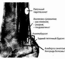 Нозете, глуждовите и долната третина на тибија зрачење и инструмент дијагностика. Патологијата на…