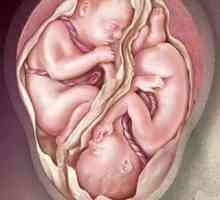 Бременост со близнаци слика