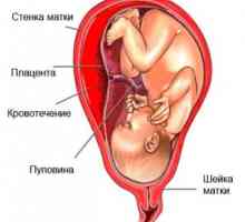 Крварење во првото тромесечје од бременоста. Зошто тие се појавуваат и дали тоа е нормално?