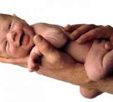 Предвремено породување и индикации за царски рез за време на бременоста и породувањето ..