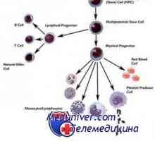 Трансплантација на матични клетки за болести акумулација и таласемија