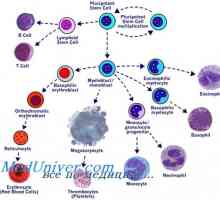 Трансплантација на матични клетки во миелопролиферативните болести mieloleykoze
