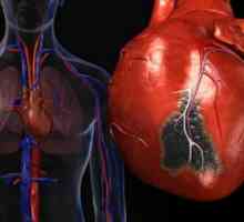 Трауматски лезии на срцето и крвните садови