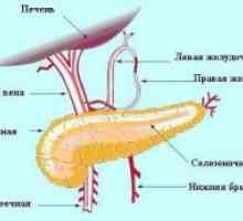 Тромбоза на спленичната артерија