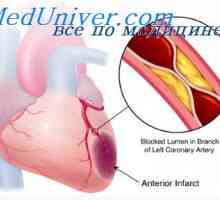 Внатрешни каротидните артерии на ембрионот. На лакот на аортата и пулмонална артерија на фетусот