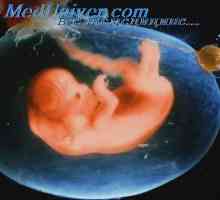 Вродени спина бифида. Причините за поделба на 'рбетот на ембрионот