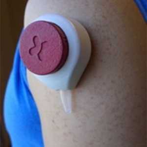 Крвниот тест без болка од страна на вакуум