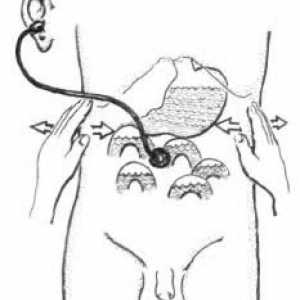 Diatermoekstsiziya (electroconization) на грлото на матката