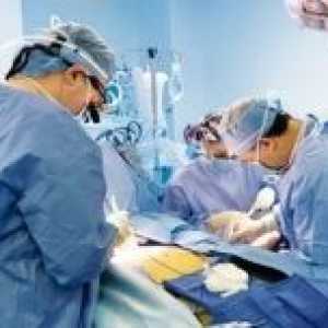 Коронарен артериски бајпас срце хируршка техника, контраиндикации, компликации, што е тоа?