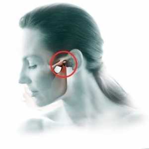 Артритис на temporomandibular заеднички: третман, симптомите, дијагноза