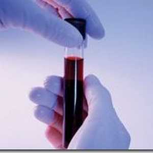 Биохемиска анализа на крвта