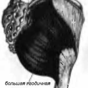 Болки во грбот предизвикани од страна на gluteus maximus
