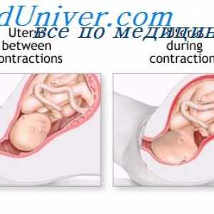 Стомачните мускули за време на породувањето. активноста на матката