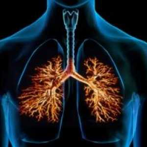 Бронхиектазии во белите дробови: третман, симптомите, дијагноза, причините, симптомите